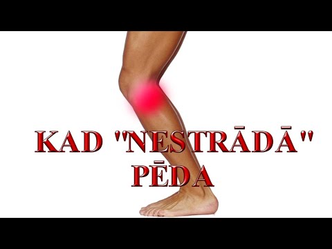 Video: Kā noteikt, vai jums ir plakana pēda?