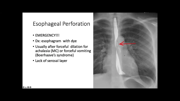 GI Exam 3: Part 1