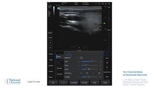 Mindray TE5 Carotid ultrasound Scan with Smart Track Feature Video Training Demonstration