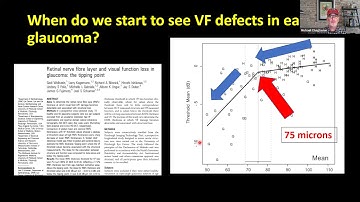 Managing Glaucoma with OCT Imaging (12/7/2021)