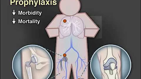 Venous Thromboembolism Prophylaxis after Hip or Knee Arthroplasty