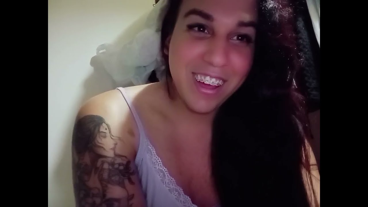 Así quedó Mi pecho después de 1año y 8mese en tratamiento hormonal,hasta que lo frené, xq es difícil