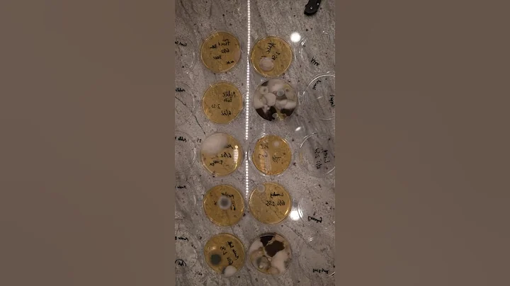 Do You Have a MOLD Problem? Testing Amazon Mold Kits