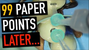 My Secret Weapon for Drying Impossible Root Canals!