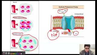 Cytotoxic Edema and Vasogenic Edema
