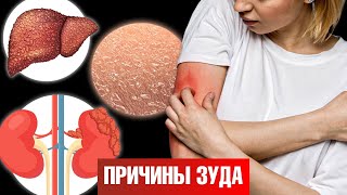 Чешется Кожа? 15 Причин Зуда, О Которых Вы Точно Не Знали 🧐