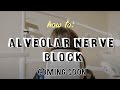 Alveolar Nerve Block (Teaser) #ubcmedicine #ubcdentistry