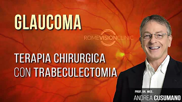 Quanto dura un intervento di Trabeculectomia?
