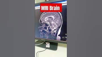 MRI BRAIN 🧠 LIVE VIDEO