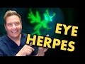 Eye COLD SORE:  diagnosis &amp; treatment of eye herpes