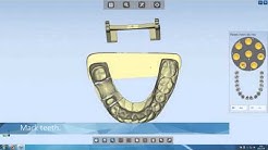 Autoscan-DS100 Shining 3D blue light dental scanner made in China