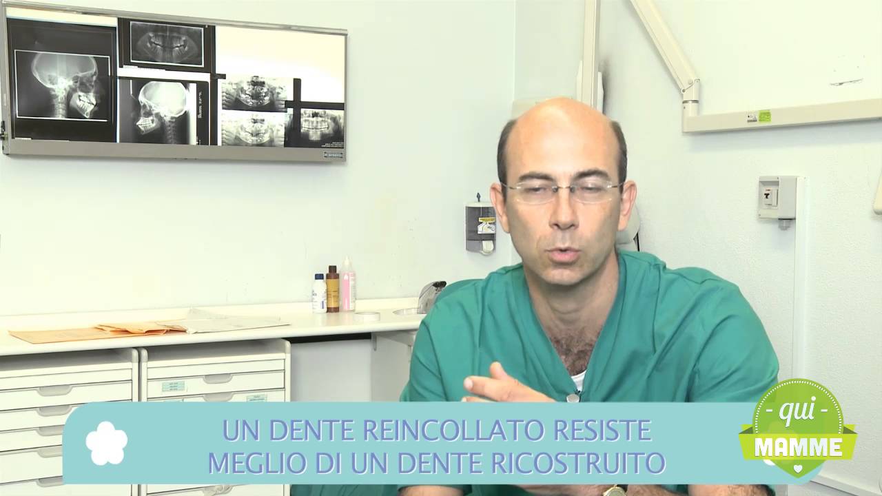 Si rompe un dentino: cosa fare?