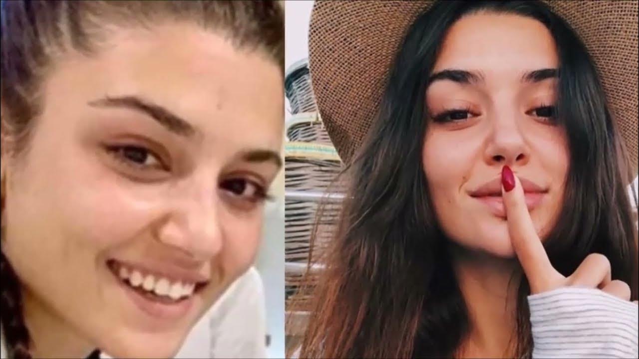 Ханде эрчел фото до и после Hande Erçel fue atrapado con un hombre por los reporteros sensacionalistas. - Yo
