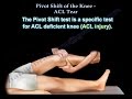 Pivot Shift Test - Everything You Need To Know - Dr. Nabil Ebraheim