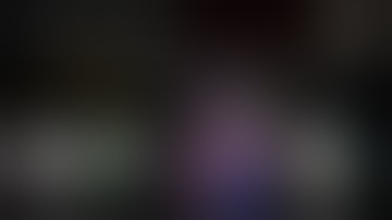 【#159】Uniportal VATS right S2 segmentectomy after LLL - Minimally Edited, As Performed