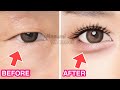 Make your Eyes Look Bigger Naturally, Create Aegyo Sal, Eye Bags with Face Yoga Exercise