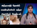 வெண்புள்ளி நோய் அறிகுறிகள் |குறைந்த மெலனின் சுரப்பு | Vitiligo-Low Melanin Secretion |Dr.Yoga Vidhya