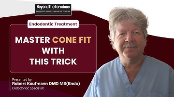 Chloroform Dip Technique: Perfecting Cone Fit in Complex Canals