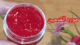 مورد القدمين