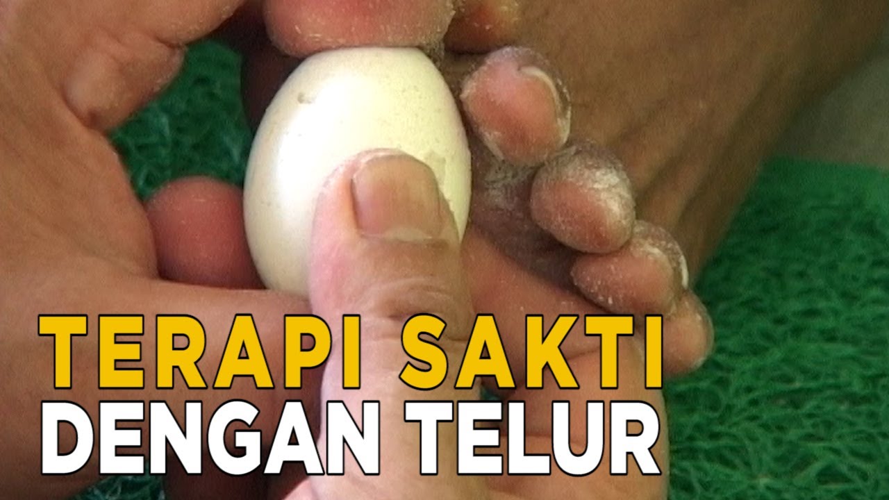 Terapi menggunakan telur bisa melancarkan peredaran darah lho | JELANG SIANG