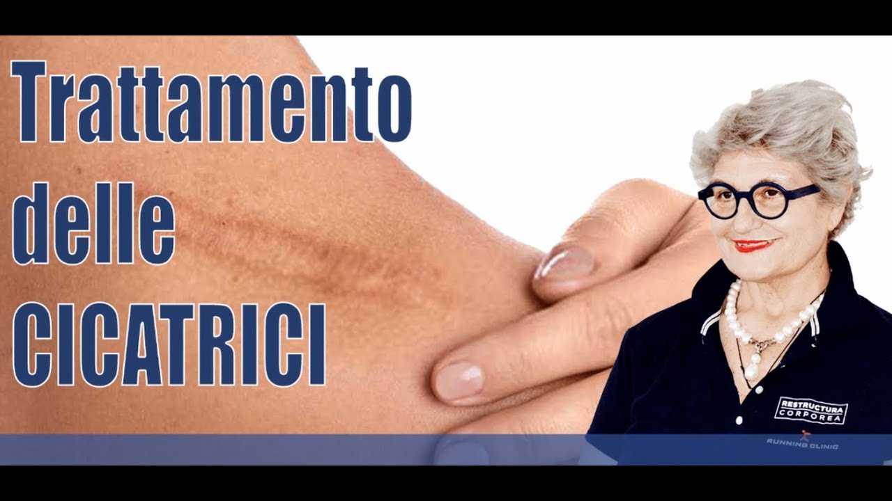Trattamento delle Cicatrici - Dott.ssa Giordani