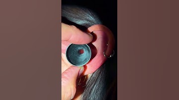 Removing a Faulty Invisible Hearing Aid  #phonak #lyric #hearingaids