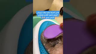 طريقة مضمونه لازالة قشره الراس للاطفال ونمو الشعر 