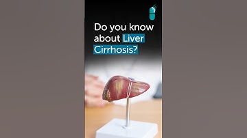 Liver Cirrhosis Without Jaundice: Swelling & Fluid Retention Explained | Gleneagles Hospital
