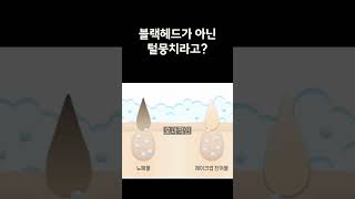 #블랙헤드 가 아닌 털뭉치라고??