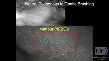 A Gene for Painful Touch