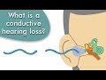 Conductive hearing loss explained