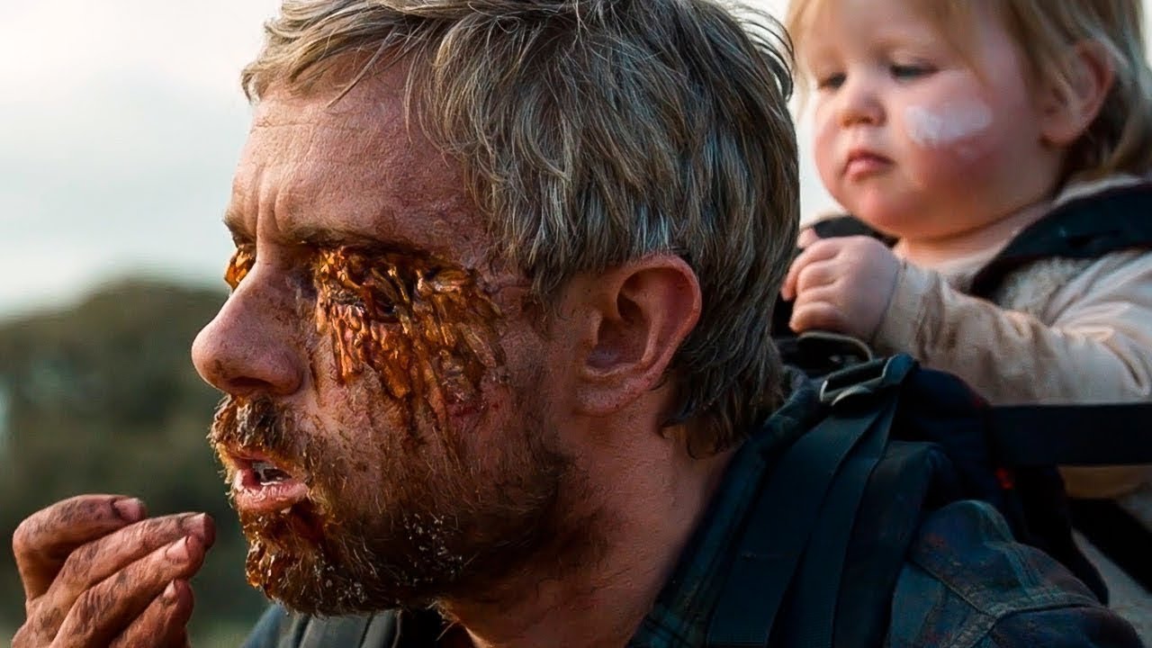 Aabo zambie ah wuxu haystaa 48 sac si uu ubadbadiyo gabartisa into noqon dhiig yacab