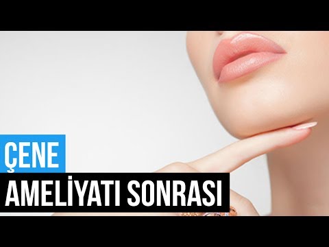Çene Ameliyatı Sonrası