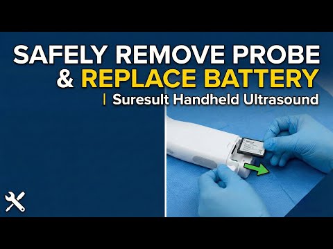 Removing the probe and replacing the battery · Setup scan preview