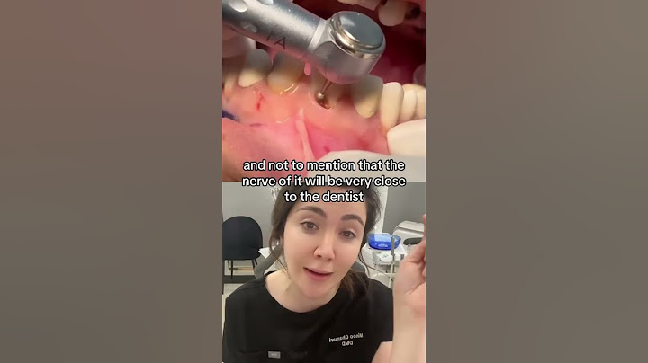 How Come The Neck Of The Tooth Catches Cavity?