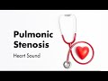 Pulmonary stenosis aka pulmonic stenosis  heart sounds  medzcool