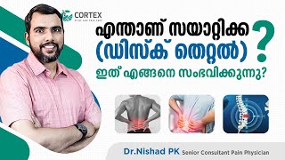 എന്താണ് സയാറ്റിക്ക (ഡിസ്ക് തെറ്റൽ )? ഇത് എങ്ങനെ സംഭവിക്കുന്നു?sciatica malayalam| Cortex Pain Care