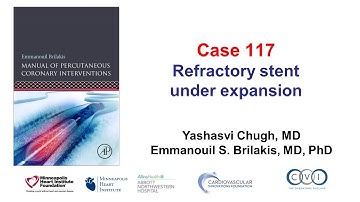 Case 117: PCI Manual - Refractory stent underexpansion