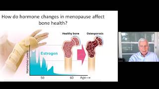 Hard facts about soft bones: Menopause and bone health screenshot 4