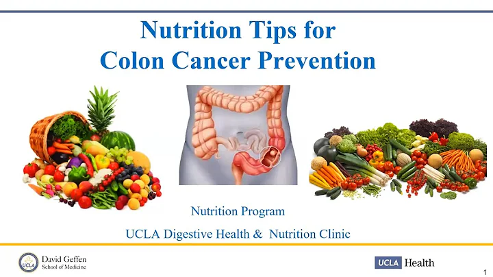 Nutrition Tips for Colorectal Cancer Prevention | ...