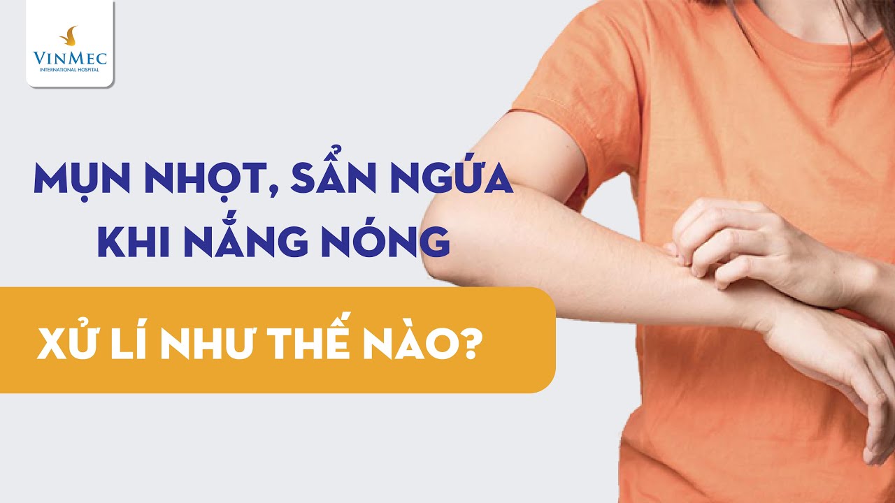 Mụn nhọt, sẩn ngứa khi nắng nóng cần xử lý như thế nào?| ThS, BS Nguyễn Duy Bộ, BV Vinmec Times City