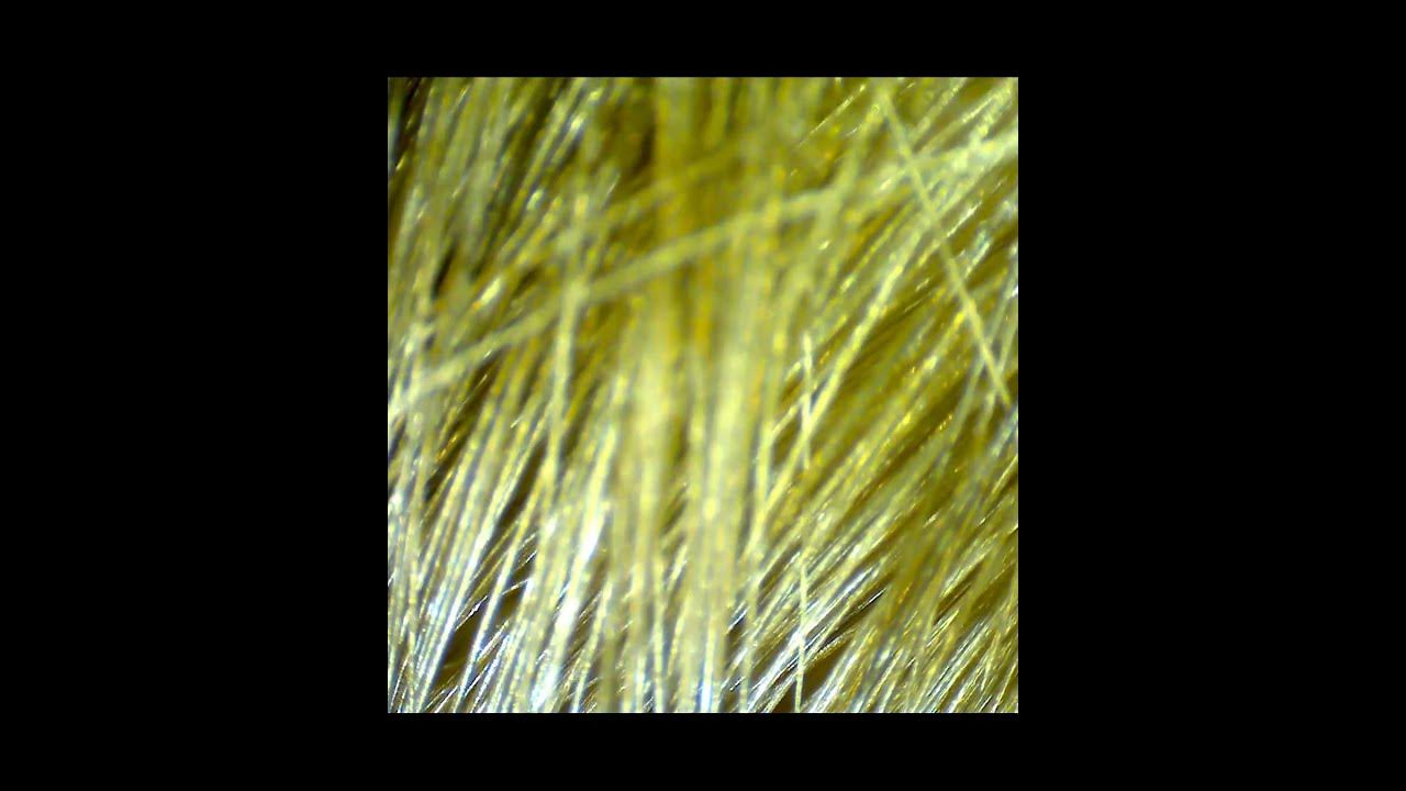 Волосы под микроскопом. Hair under the microscope 200x. Как выглядят ...