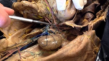 Cat Dissection - Abdominal Arteries