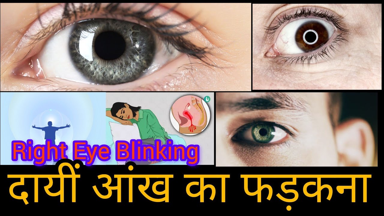 Dayi Aankh Ka Fadakna Right Eye Twitching dayi-aankh-ka-fadakna-right-eye-twitching