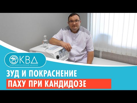 😐 Зуд и покраснение в паху при кандидозе. Клинический случай №245