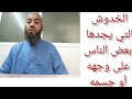 الخدوش والبقع الزرقاء يدلان على وجود سحر أو عين أو مس عند الشخص الحلقة 24 الخدوش والبقع الزرقاء يدلان على وجود سحر أو عين أو مس عند الشخص الحلقة 24