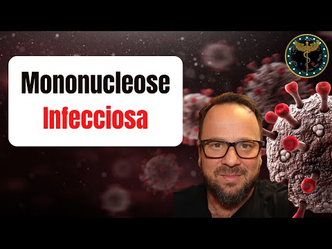 Síndrome da Mononucleose Infecciosa (doença do beijo) - Renato Cassol Médico Infectologista