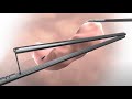 Animation of sleeve gastrectomy with standard clamp