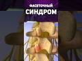 Фасетки, не шалите 👆🏻 #фасетки #фасеточныйсиндром #массаж #поясница