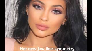 Kylie Jenner's Plastic Surgery Transformation